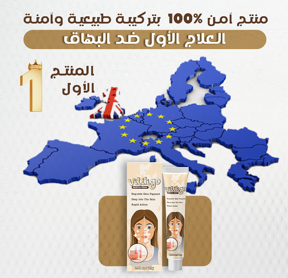كريم البهاق vitiligo