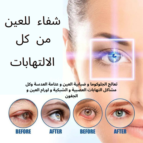 قطرات العين VENIN D'ABEILLE