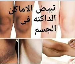 كريم تبيض المناطق الحساسة
